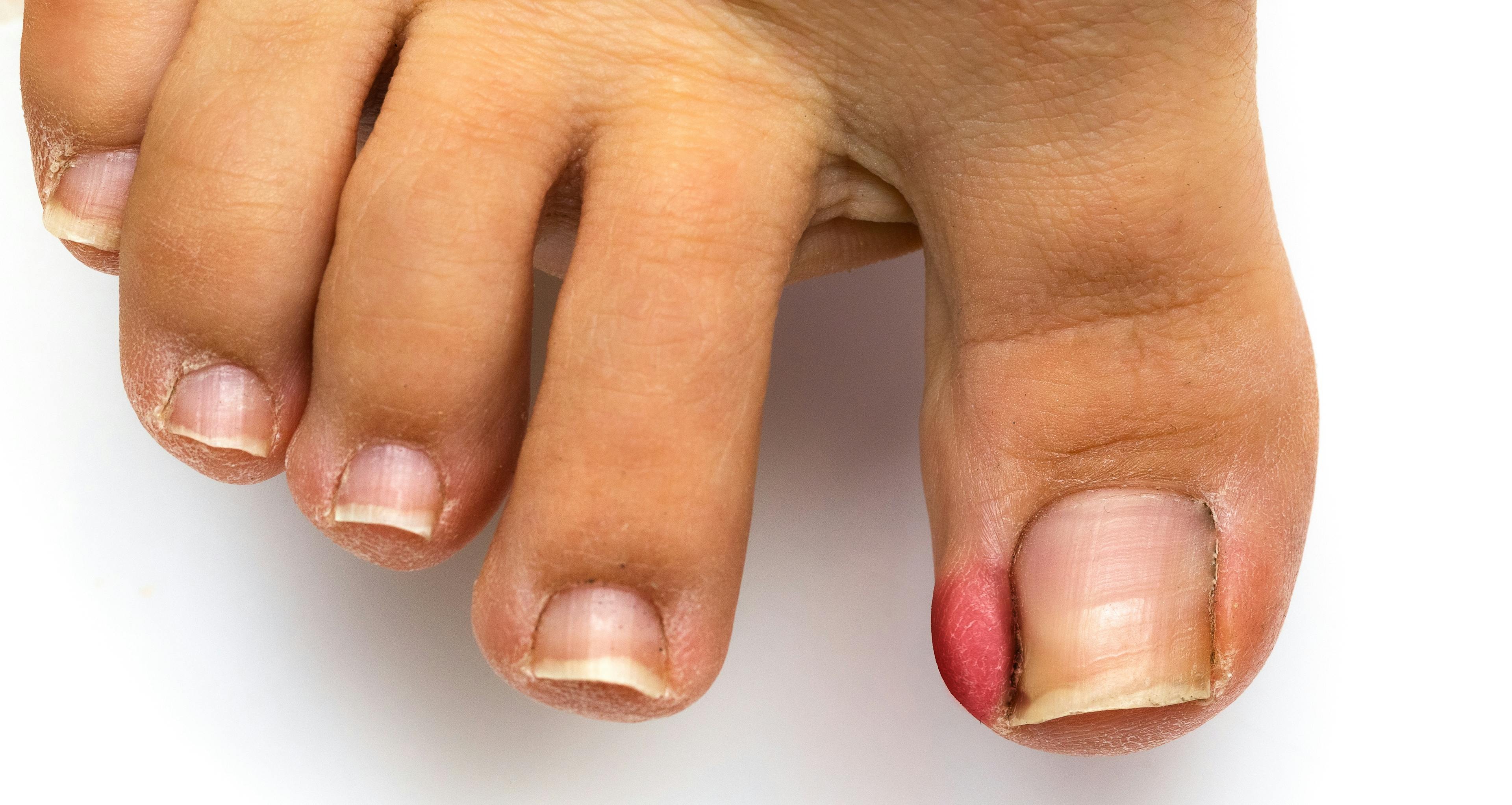 General Podiatry