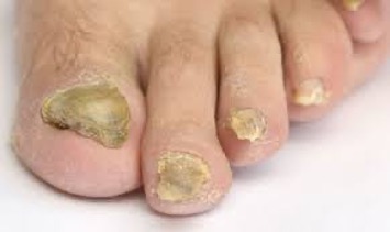 General Podiatry