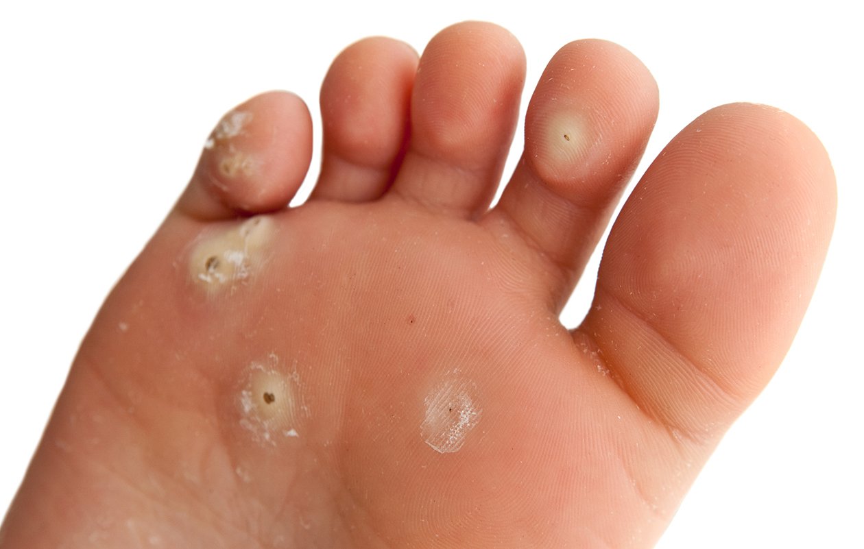 General Podiatry